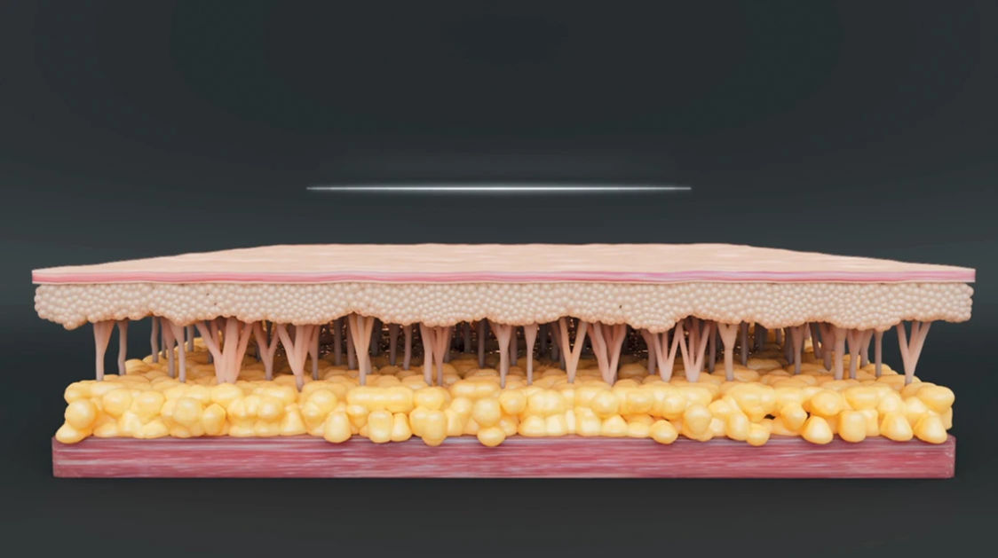 kuidas see toimib foto